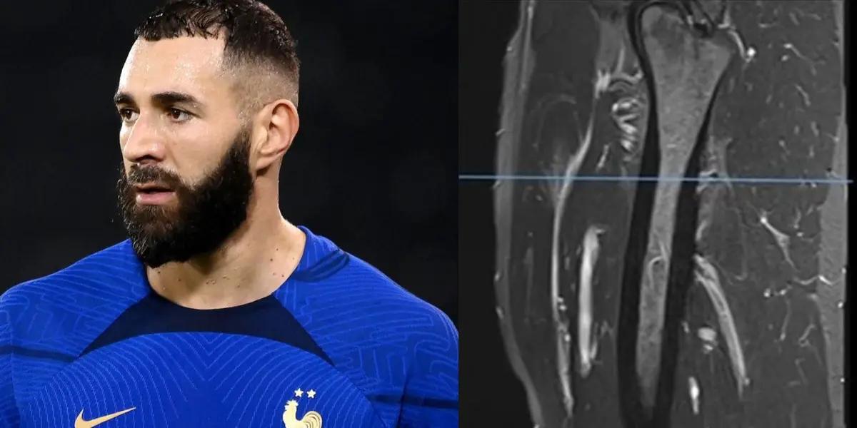 El delantero del Real Madrid podría haber jugado para Francia desde octavos de final.