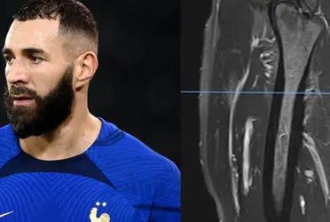 El delantero del Real Madrid podría haber jugado para Francia desde octavos de final.